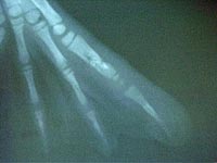 X-ray of flipper